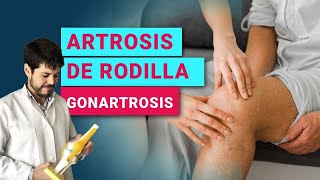 ¿QUÉ ES LA ARTROSIS DE RODILLA GONARTROSIS  PROLOTERAPIA  PRP  CÉLULAS MADRE [upl. by Brynne]