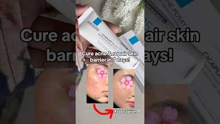 I cured my acne and damaged skin barrier in 7 days acne skinbarrier larocheposay Damagedbarrier [upl. by Colombi818]