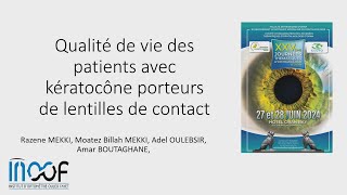 Qualité de vie des patients avec Kératocône porteurs de lentilles de contact [upl. by Masry]