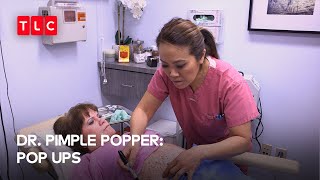 Dr Sandra takes on Neurofibromatosis  Dr Pimple Popper Pop Ups [upl. by Ahsenwahs563]