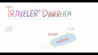 Travelers Diarrhea  definition causes clinical findings diagnosis prevention and management [upl. by Zephan]