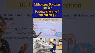 Lithotomy Position क्या है  Patient को कब क्यों और कैसे देते हैं reels medicalstudent shorts [upl. by Laurance691]