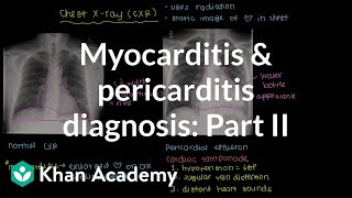 Diagnosis of myocarditis and pericarditis part 2  NCLEXRN  Khan Academy [upl. by Demaggio790]