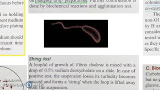 Microbiology 228 a Vibrio cholerae Cholera Lab Diagnosis [upl. by Ahsinrev]