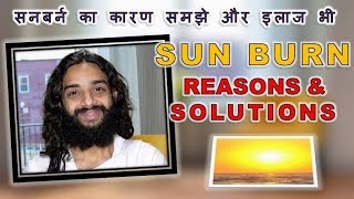 SUN BURN  SUN ALLERGY REASONS amp SOLUTIONS BY NITYANANDAM SHREE [upl. by Strenta93]