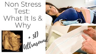 Non Stress Test During Pregnancy What To Expect 33WK Update NST [upl. by Lletnohs727]