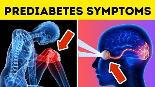 Top 12 PREDIABETES Symptoms and Treatment You Shouldt IGNORE [upl. by Malachy104]