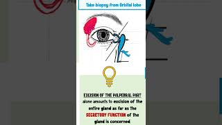 lacrimal apparatus anatomy ophthalmology [upl. by Arick]