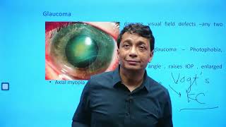 Ophthalmology  Rapid Revision  Part 2  Target FMGE 2024  Dr Saswat Ray720PHD [upl. by Elirpa976]