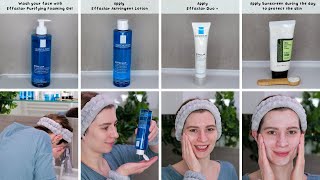 How to use La Roche Posay Effaclar 3Step Kit  Routine for Oily Skin [upl. by Dee Dee]