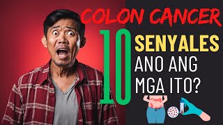 10 Mahahalagang Senyales Ng Colon Cancer Na Dapat Mong Malaman  Warning Signs Ng Colon Cancer [upl. by Tung887]