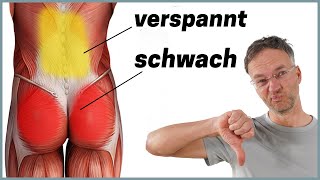 Die häufigste Ursache für Rückenschmerzen Anatomie erklärt [upl. by Dave678]