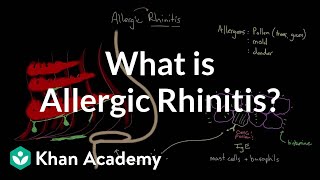 What is allergic rhinitis  Respiratory system diseases  NCLEXRN  Khan Academy [upl. by Rengia516]