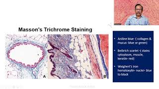 MD DNB Practical CONNECTIVE TISSUE STAINS Massons Trichrome Univ Exam [upl. by Kenny551]