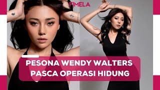 Penampilan Terbaru Wendy Walters Pasca Operasi Hidung Cantiknya Banjir Pujian dan Dukungan [upl. by Sydalg]