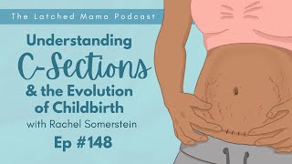 CSections and the Evolution of Childbirth with Rachel Somerstein  The Latched Mama Podcast Ep148 [upl. by Farrah]