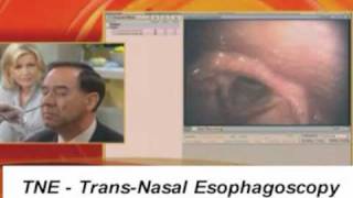 TNE TransNasal Esophagoscope Endoscopy Endoscope GMA [upl. by Aelem851]