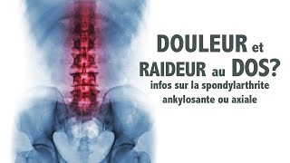 Raideur au dos info sur la spondylarthrite ankylosante ou axiale [upl. by Noicnecsa]