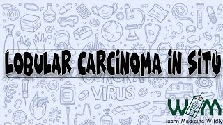 Lobular Carcinoma in Situ [upl. by Oilla]