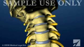 Cervical Spine and Intervertebral Disc Anatomy  Female Version [upl. by Jeno518]