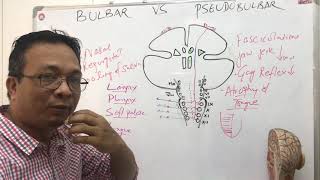 bulbar palsy vs pseudobulbar palsy [upl. by Amargo]