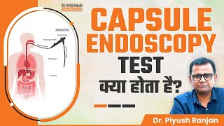 क्या है Capsule Endoscopy Test जानें कब और क्यों किया जाता है  Dr Piyush Ranjan [upl. by Dyche748]