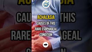 ACHALASIA CAUSES OF THIS RARE ESOPHAGEAL CONDITION shorts achalasia esophagus doctor [upl. by Alarise]