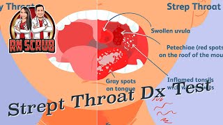 Strep throat streptococcal pharyngitis  Diagnostic Testing [upl. by Rhyner]