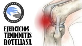 Tendinitis rotuliana ejercicios tratamiento y rehabilitacion [upl. by Mlehliw]