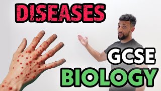 GCSE Biology  Infectious Diseases Rap [upl. by Julianne]