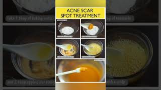 Home Remedies For Acne And Pimples ❤️❣️skincare acnetreatment shortvideo [upl. by Curr199]