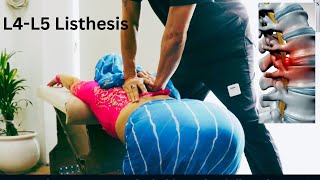 HOW TO TREAT BACKPAINL4L5 Anterolisthesis Best Chiropractor in India Immediate relief [upl. by Edualc966]