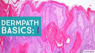 Basic Dermpath Cases  Explained by a Dermatopathologist [upl. by Benisch630]