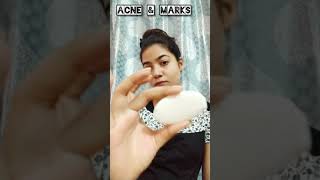 Acnestar Gel and Soap  Remove pimples Acnestar shorts ytshorts skincare acne [upl. by Annaet]