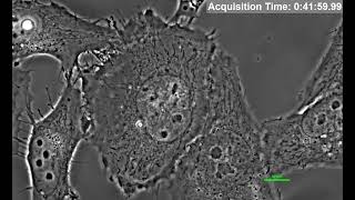 HeLa cell Live cell imaging Cell division Mitosis Time lapse Phase contrast microscopy [upl. by Vilhelmina]