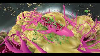 HCC pathophysiology treatments and mechanisms [upl. by Eniamsaj326]