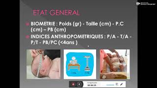 EXAMEN CLINIQUE EN PEDIATRIE Dr M GHARNOUTI [upl. by Barraza891]