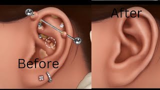 ASMR ear cleaning roleplay  professional ear cleaning ASMR [upl. by Doran]