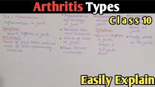 Arthritis  Osteoarthritis  Rheumatoid  Gout  Class 10 Biology UrduHindi [upl. by Isnan]