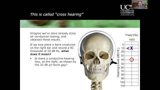 Introduction to Clinical Masking in Audiology [upl. by Intosh]