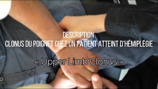 Clonus du poignet chez les patients un atteint d’hémiplégie « Upper Limb Clonus » [upl. by Tosch]