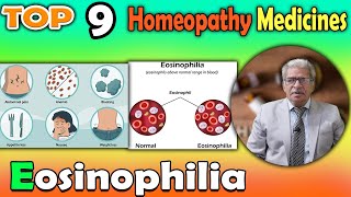 Eosinophilia Symptoms and homeopathy medicine  Dr P S Tiwari [upl. by Gilemette511]