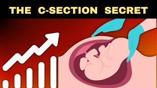 The Truth About Rising CSections  Cesarean Births [upl. by Enaitsirhc551]