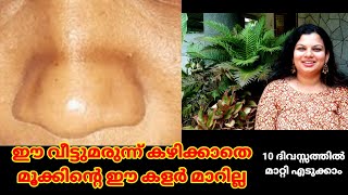 മൂക്കിൻ്റെ കുറുകെ വരുന്ന കറുത്ത വര മാറാൻ get rid of nose pigmentation [upl. by Nodgnal]