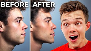 How To Get A Sharper Jawline [upl. by Nivac601]