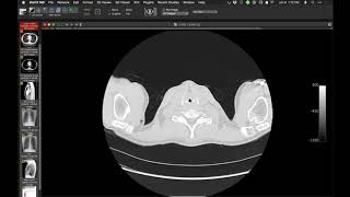 STR Cardiothoracic Case Webinar 192020 [upl. by Hcurab472]