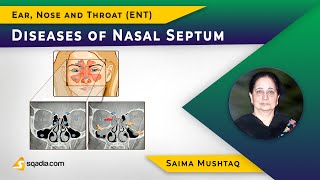 Diseases of Nasal Septum  ENT Video Lectures  Medical Education  VLearning [upl. by Anwahsar]