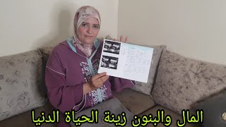 انا حامل للمرة؟؟ردة فعل اسرتي 🙈🙈🥳🥳🥳 [upl. by Nnylireg465]