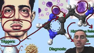 Understanding Hives Urticaria Symptoms Causes and Treatments [upl. by Goody903]