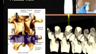 Regional Anesthesia  Ultrasound Assisted  Guided Neuraxial Block [upl. by Jeggar966]